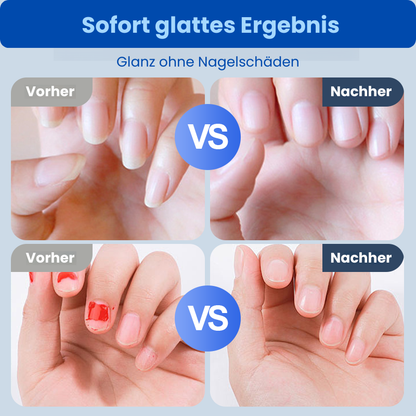 NagelCare Plus™ - Moderne Nagelpflege für die ganze Familie