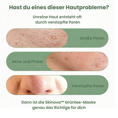 Skinova™ Grüntee-Maske - Klärende Pflege für ausgeglichenes Hautbild