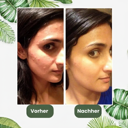 Skinova™ Grüntee-Maske - Klärende Pflege für ausgeglichenes Hautbild