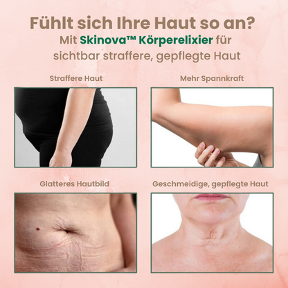 Skinova™ Körperelixier - Für geschmeidige Haut mit neuer Ausstrahlung